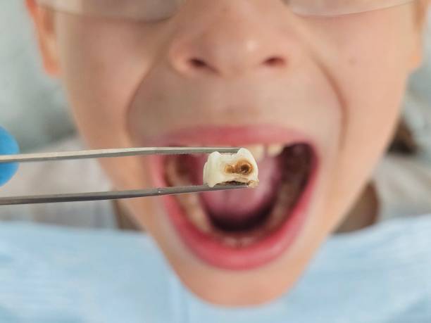 Emergency Gum Pain Relief in IA